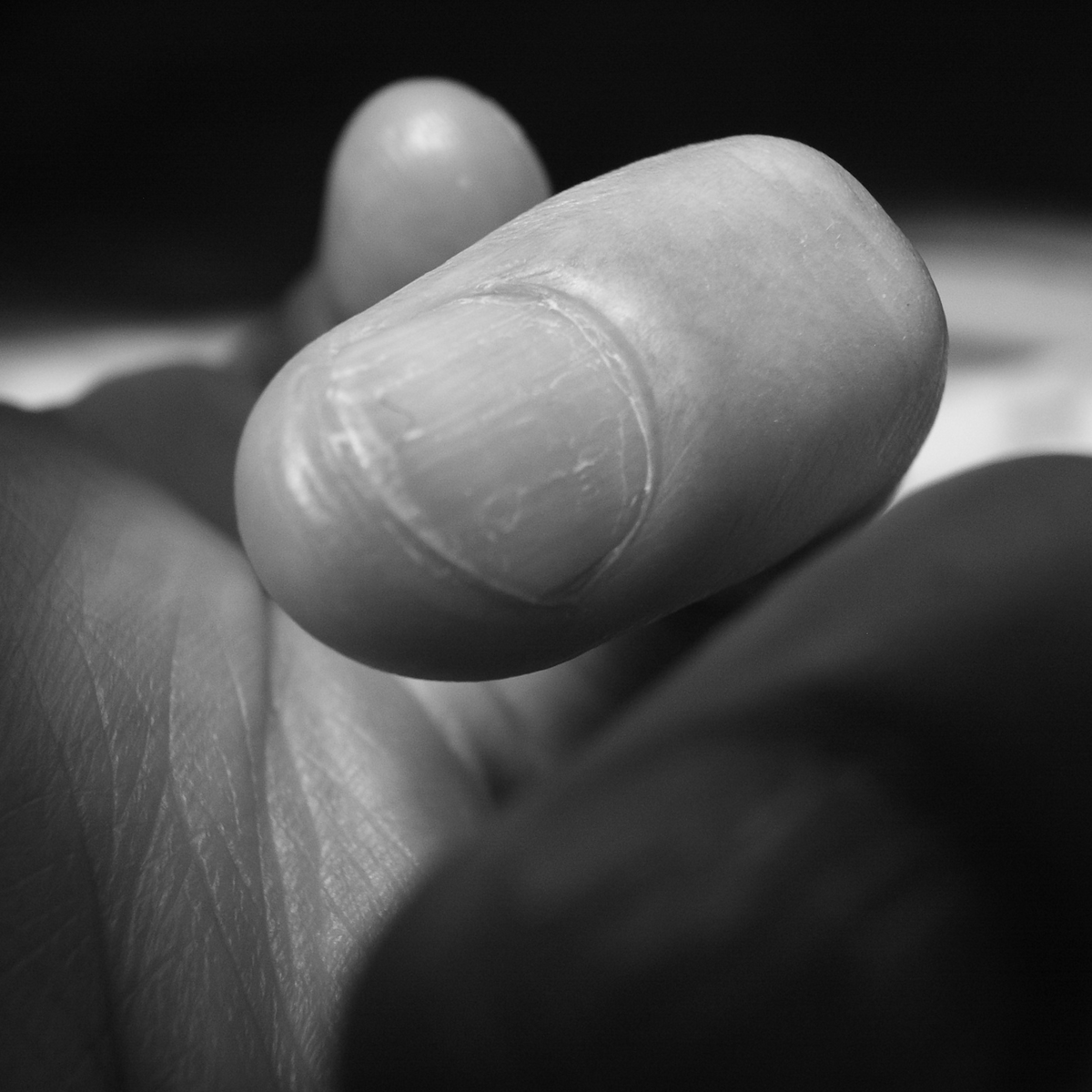 What to Do Chemotherapy and Nails Nailpro