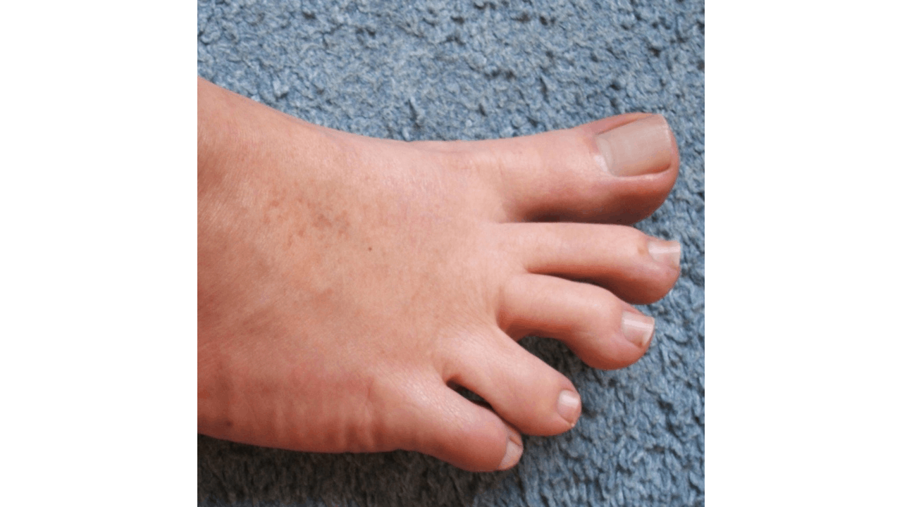 Toe transparent 2024