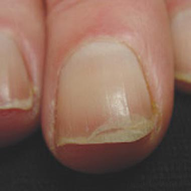 How to Stop Your Nails from Peeling: 12 Steps (with Pictures)