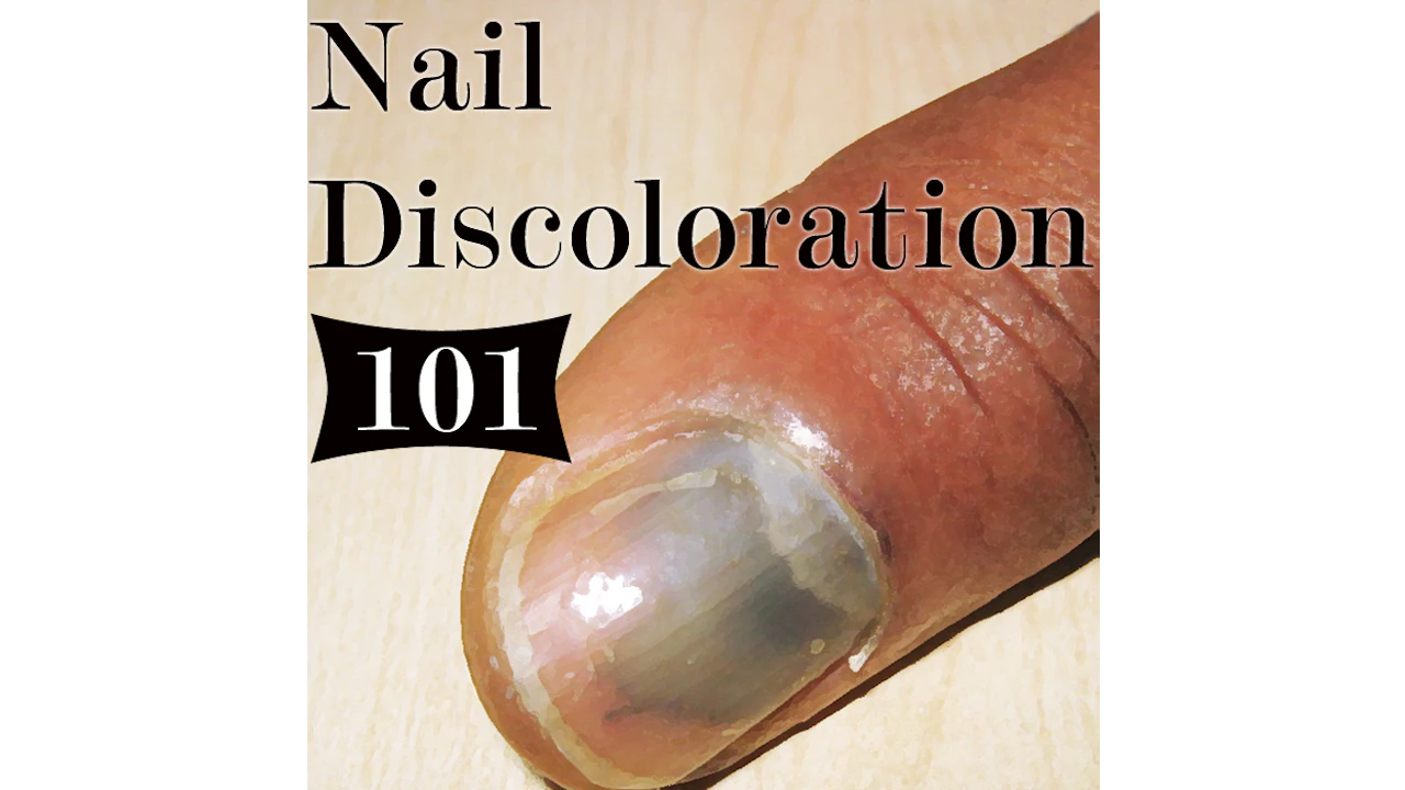 Black Spot On Toenail Near Cuticle Nail Ftempo black-spot-on-toenail-near-cuticle-nail-ftempo
