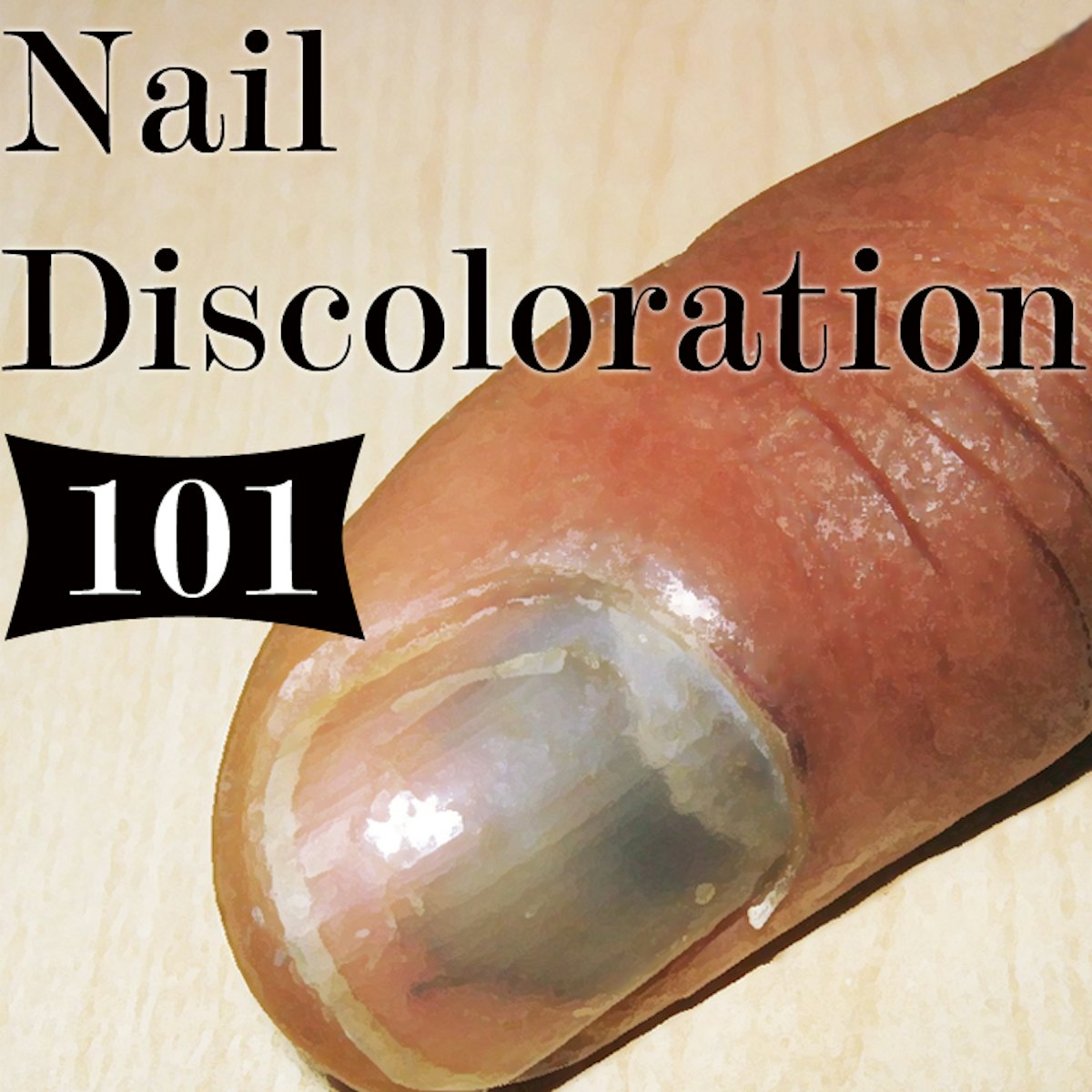 What Discoloration Of The Nail Means Nailpro