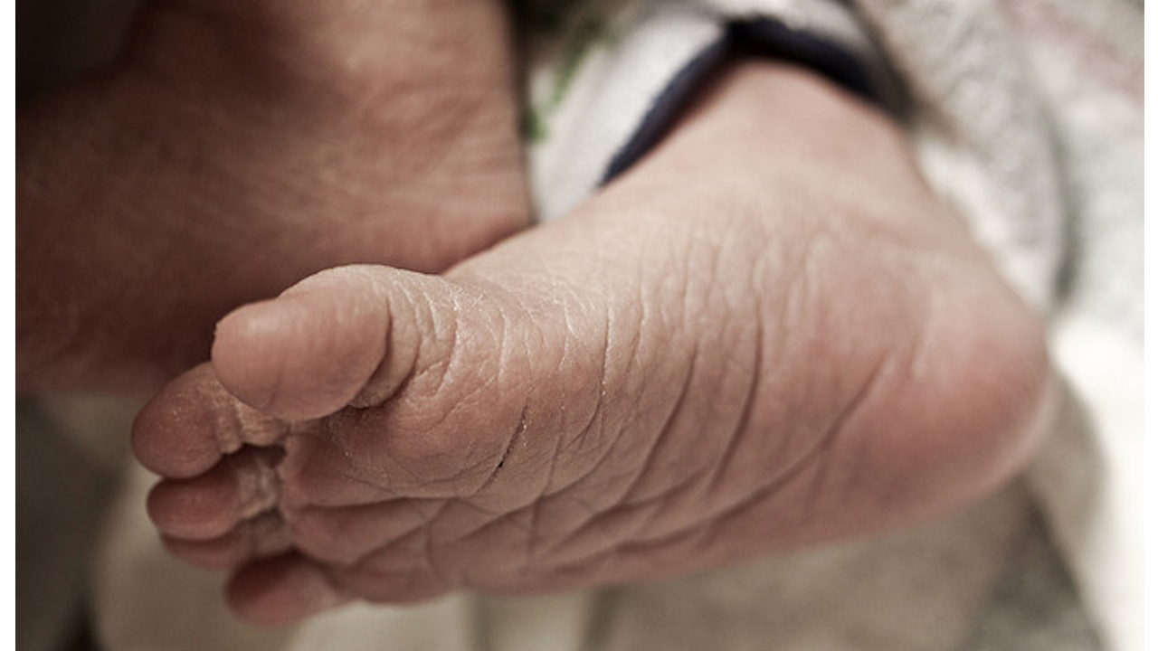 Thick Toenails Causes And Treatment Nailpro