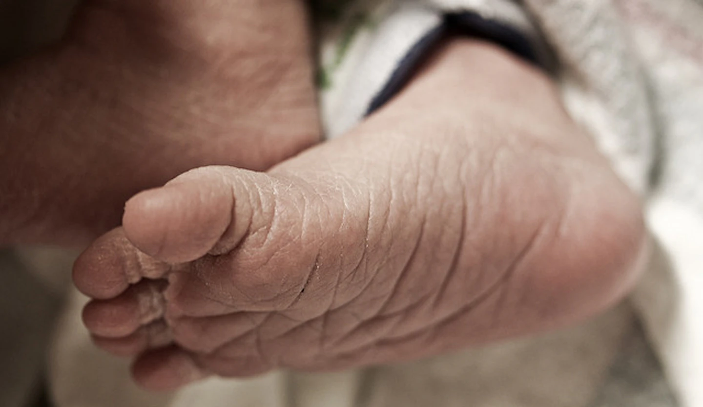 Thick Toenails Causes And Treatment Nailpro