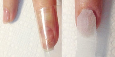 How to Fix Peeling, Cracking, and Broken Nails | Nailpro