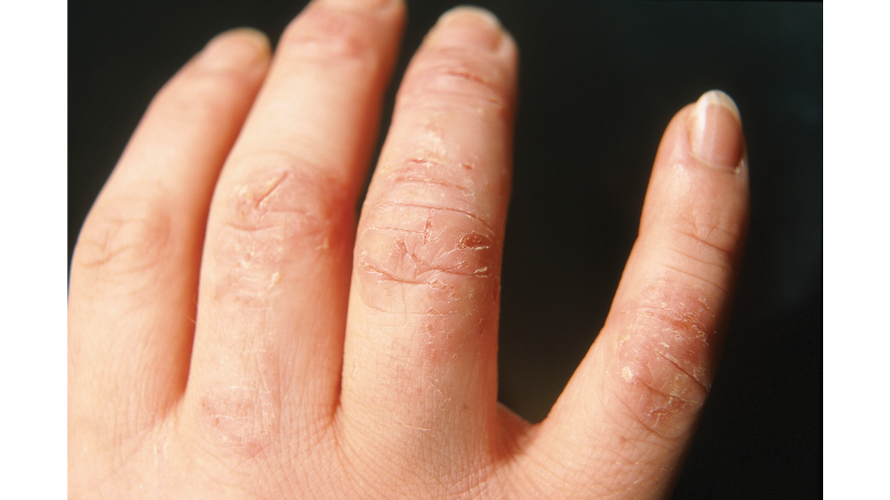 What Does It Mean If Your Client Has Greenies Pure Nails