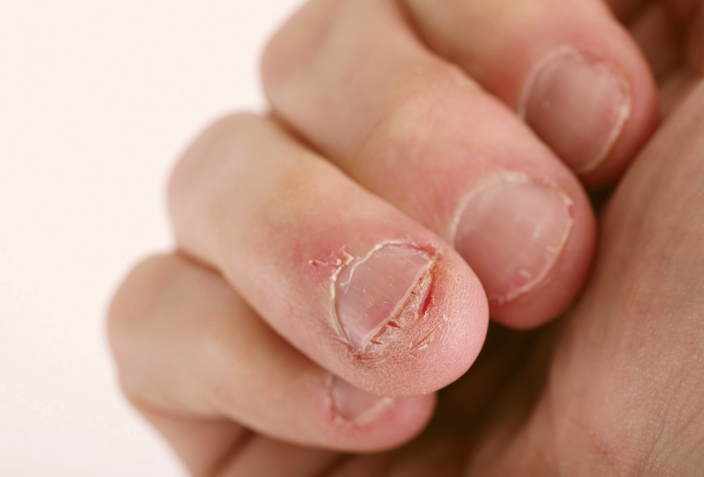 How To Tackle The 3 Most Common Health Issues In The Salon Nailpro How To Tackle The 3 Most Common Health Issues In The Salon Nailpro