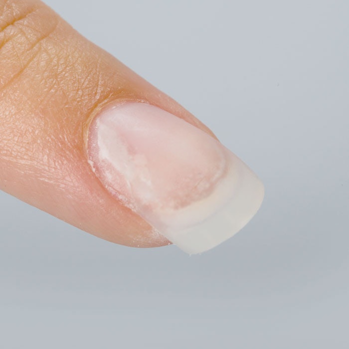 Four Nail Experts Weigh In On How To Stop Lifting Nailpro