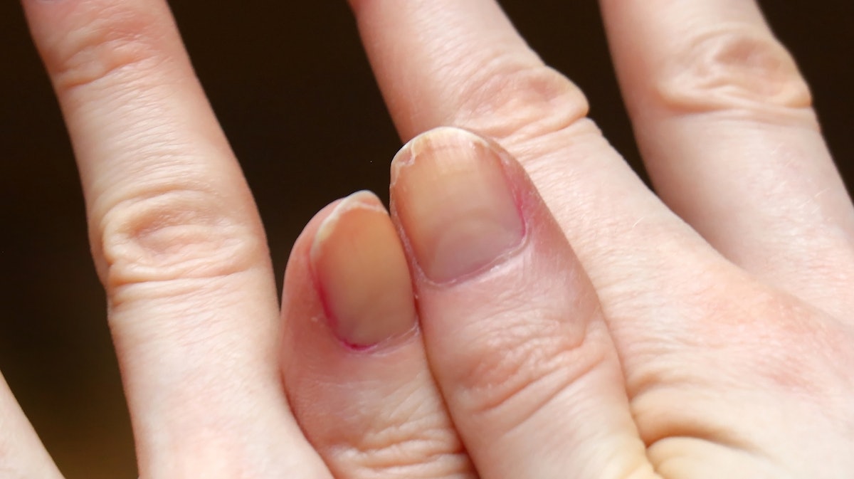 What Peeling Nails Mean and How to Prevent Them Nailpro