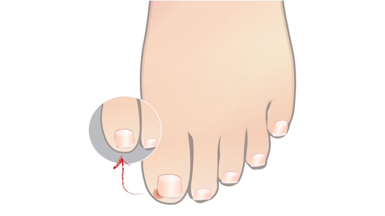 Five reasons not to use acrylic nails on toes